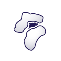 E3 Ligase – Neo-Degron Interactions